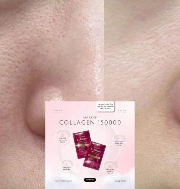 Collagen 15000mg Nhật Bản - Collagen tốt lành & tiết kiệm